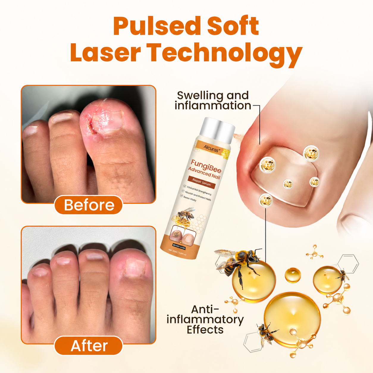 Alcuras® FungiBee Advanced Nail Repair Spray
